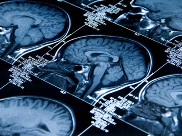 Titleimage: Doctoral Program for Cognition, Learning, and Memory Titleimage: Doctoral Program for Cognition, Learning, and Memory